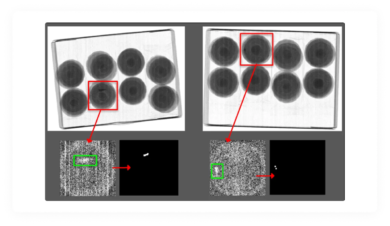 Detailed X-ray analysis